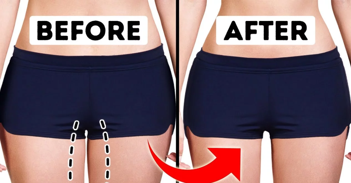 You are currently viewing How to Lose Weight in Your Thighs